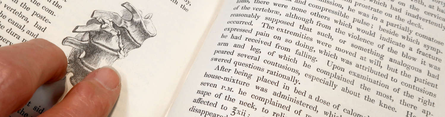 Kim Crowder's fingers on the pages of Astley Cooper's Treatise on Dislocations and Fractures showing an illustration of fractured vertebrae and words relating to the case of William Bilson